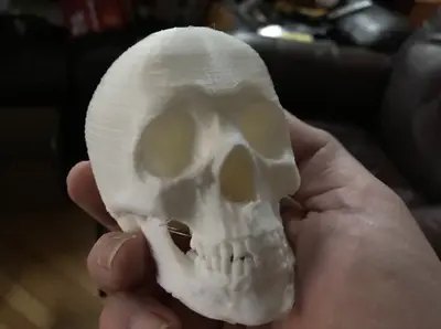 Skull