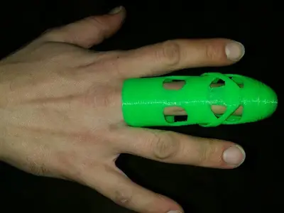 Finger Prosthesis