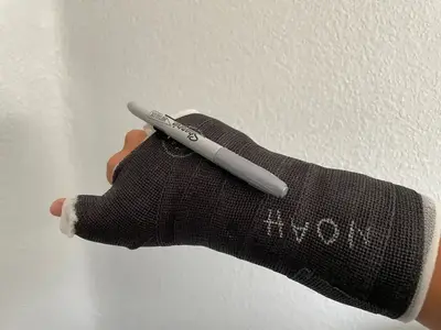 Sharpie Clip For Cast