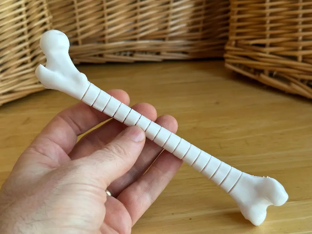 Femur
