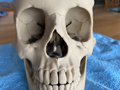 Human skull