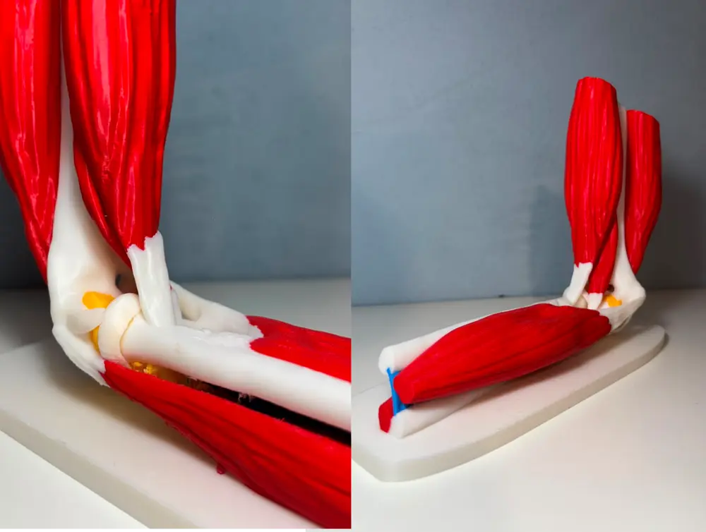 Anatomical Elbow (with Muscles and Ligaments)