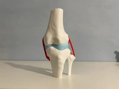Knee with Meniscus and Collateral Ligaments