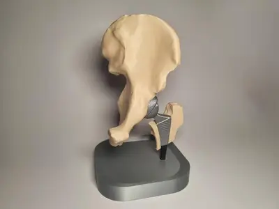 Hip Prosthesis Anatomical Model